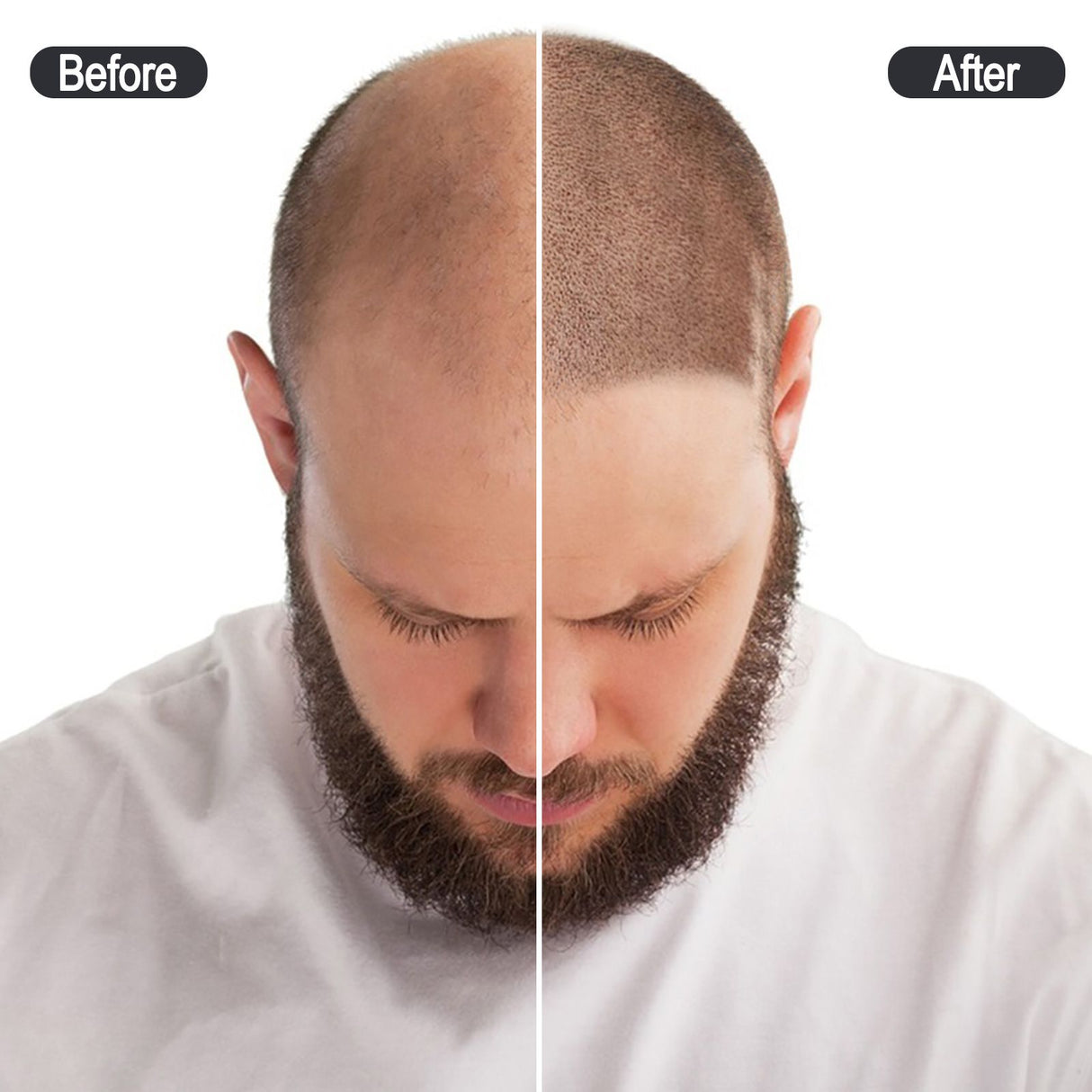 CNCSMP Black Ink for Scalp Micropigmentation 15ml