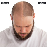 CNCSMP Black Ink for Scalp Micropigmentation 15ml